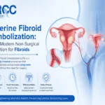Uterine Fibroid Embolization: The Modern Non-Surgical Solution for Fibroids