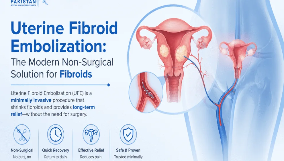 Uterine fibroid embolization modern relief