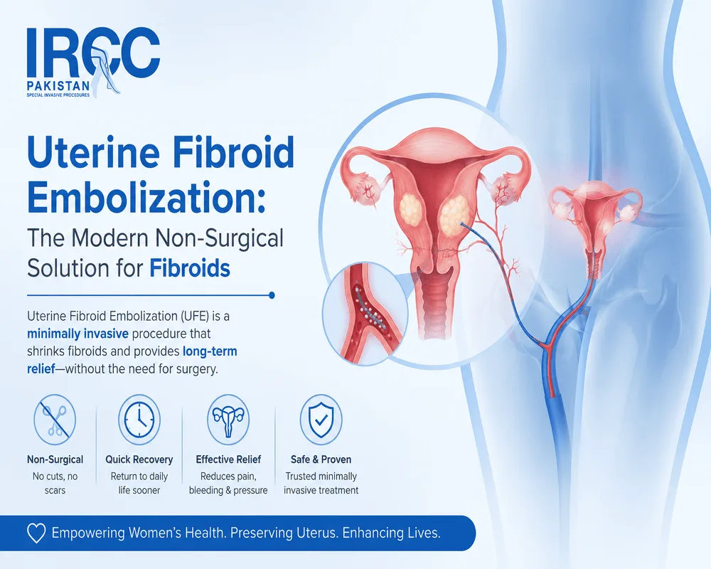 Uterine fibroid embolization modern relief